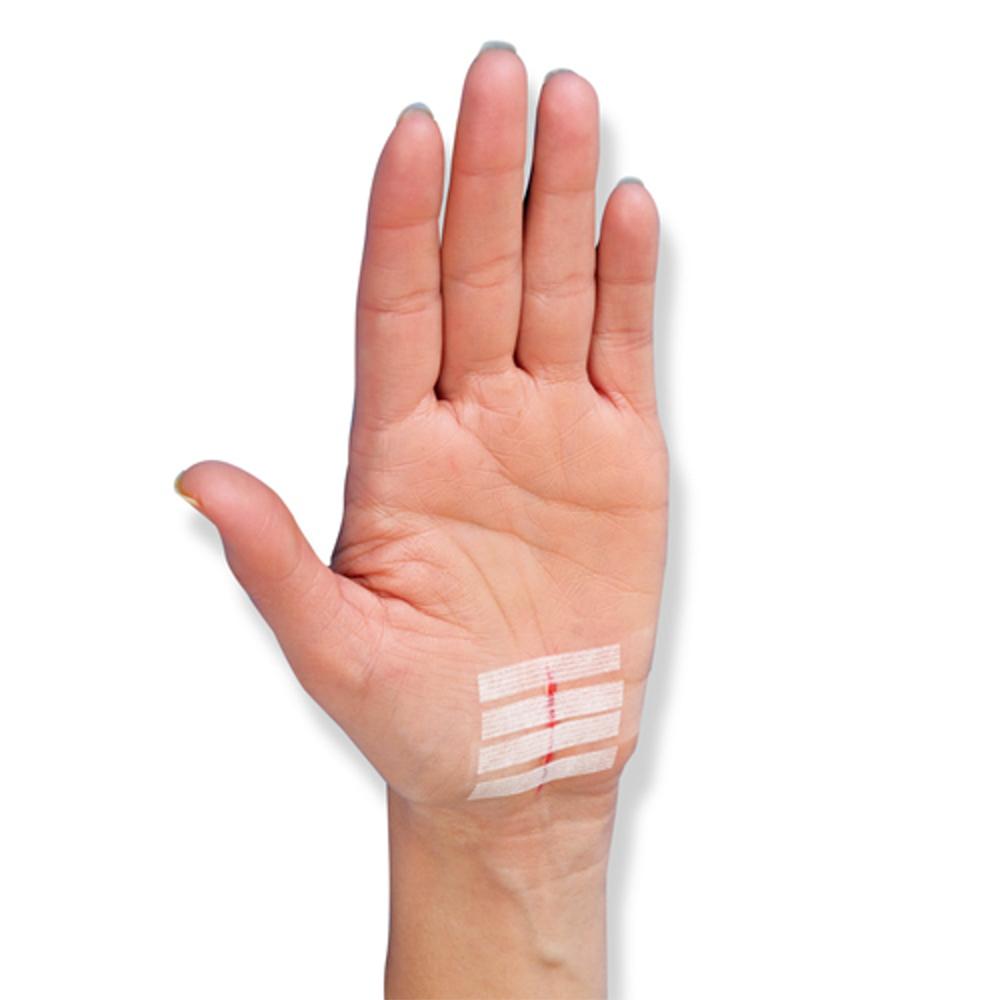 3M Steri–Strips Adhesive Skin Closures - The First Aid Gear Shop